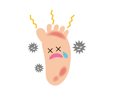 水虫の治療方法